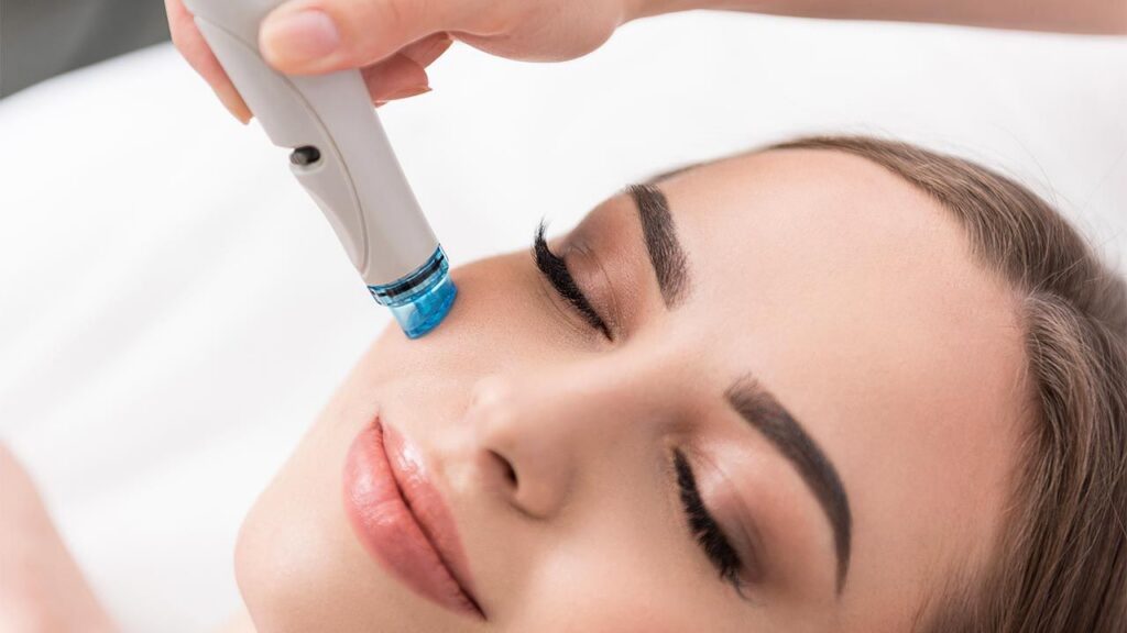 higiene facial con punta de diamante en cartagena avenida de america